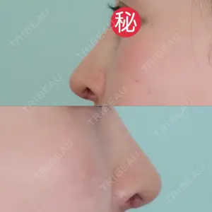 口コミ