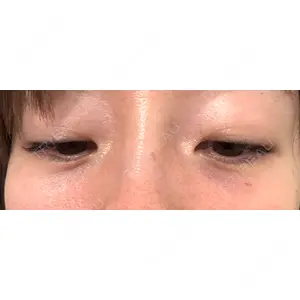 APスキンクリニック銀座口コミ