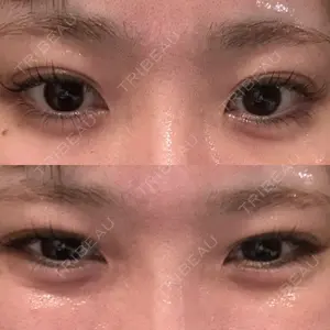 フィラークリニック フィラークリニック 大阪心斎橋院口コミ