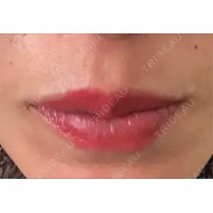 口コミ