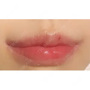 R Beauty CLINIC R Beauty CLINIC 銀座院口コミ