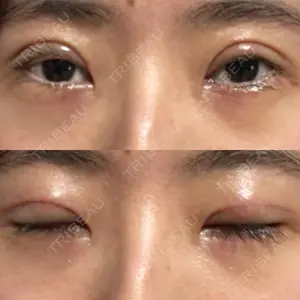 オーキッド美容クリニック東京御徒町口コミ
