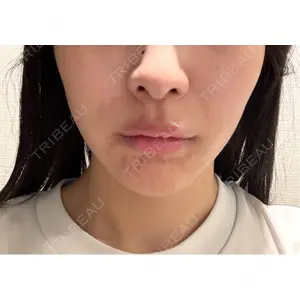 口コミ