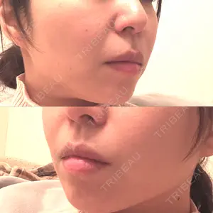 口コミ