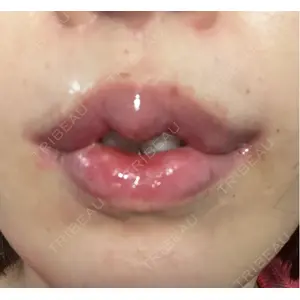 R Beauty CLINIC R Beauty CLINIC 銀座院口コミ
