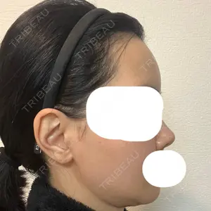 セギム美容整形外科口コミ