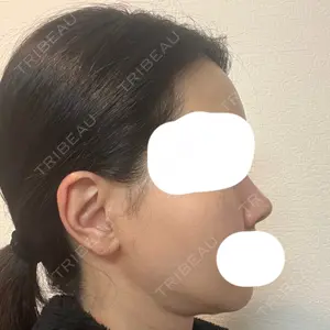 セギム美容整形外科口コミ