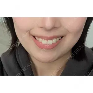ルラ美容クリニック ルラ美容クリニック 札幌院口コミ