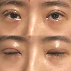 オーキッド美容クリニック東京御徒町口コミ