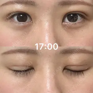 ルラ美容クリニック ルラ美容クリニック 名古屋本院口コミ
