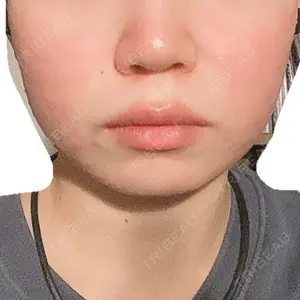 口コミ