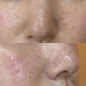 BIZENNクリニック【ビゼンクリニック】口コミ