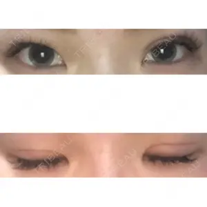 口コミ