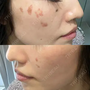 APスキンクリニック銀座口コミ
