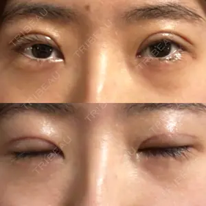 オーキッド美容クリニック東京御徒町口コミ