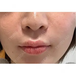 ギャラリークリニック ギャラリークリニック 銀座口コミ