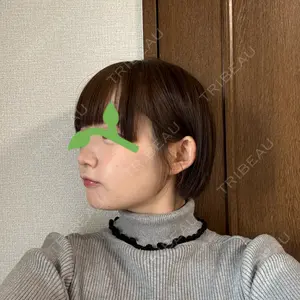BiBiクリニック口コミ
