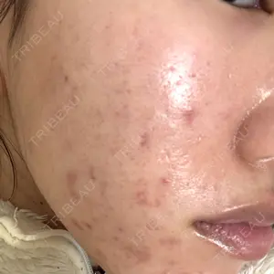 DAILY SKIN CLINIC DAILY SKIN CLINIC 福岡院口コミ