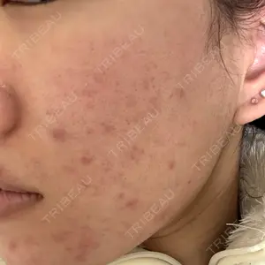 DAILY SKIN CLINIC DAILY SKIN CLINIC 福岡院口コミ