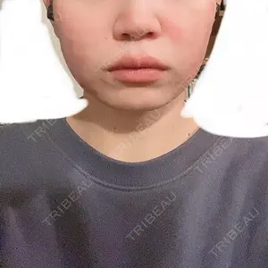 口コミ