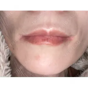 TCB東京中央美容外科 神戸院の