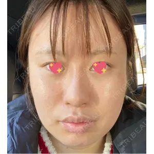 口コミ