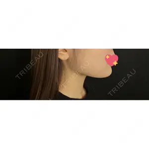藤・ナチュレ美容クリニック 藤・ナチュレ美容クリニック 銀座院口コミ