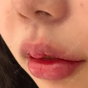 R Beauty CLINIC R Beauty CLINIC 銀座院口コミ