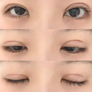 口コミ