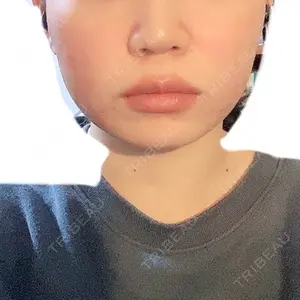口コミ