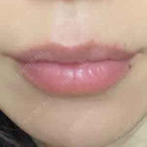 ルラ美容クリニック ルラ美容クリニック 名古屋本院口コミ