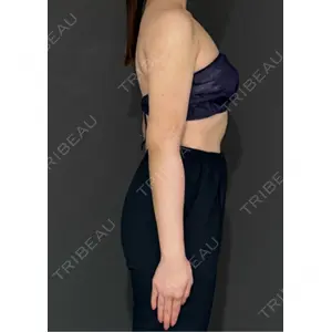 Lipo Clinic omotesando口コミ
