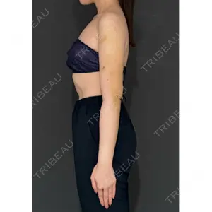 Lipo Clinic omotesando口コミ