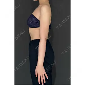 Lipo Clinic omotesando口コミ