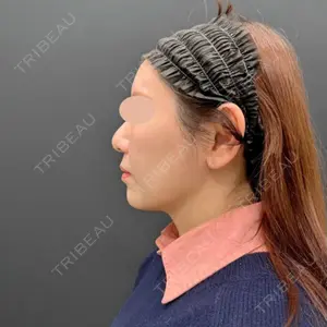 湘南美容クリニック 湘南美容クリニック 吉祥寺院口コミ