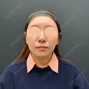 湘南美容クリニック 湘南美容クリニック 吉祥寺院口コミ