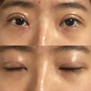 オーキッド美容クリニック東京御徒町口コミ