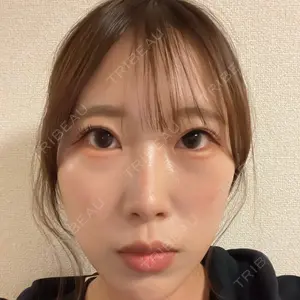 AYANAフィラーズクリニック AYANAフィラーズクリニック 渋谷院口コミ