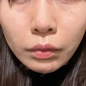 口コミ