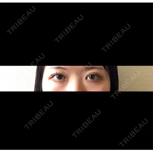 HAAB×DREAM BEAUTY CLINIC HAAB×DREAM BEAUTY CLINIC 東京本院口コミ