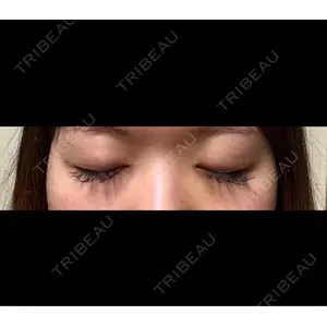 HAAB×DREAM BEAUTY CLINIC HAAB×DREAM BEAUTY CLINIC 東京本院口コミ