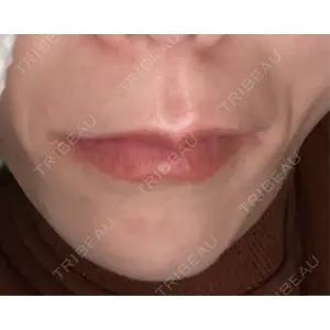 TCB東京中央美容外科 神戸院の