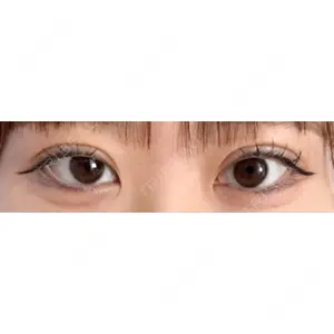 口コミ