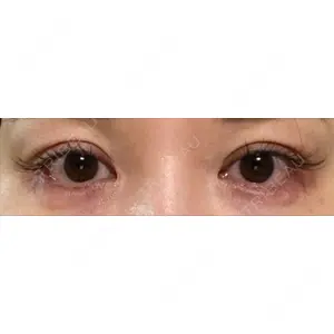 口コミ