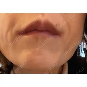 TCB東京中央美容外科 神戸院の