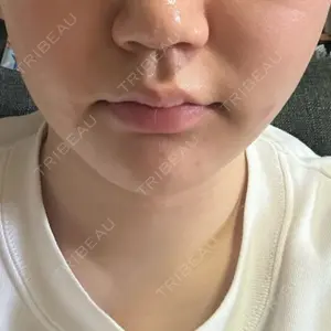 口コミ