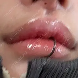 R Beauty CLINIC 銀座院の