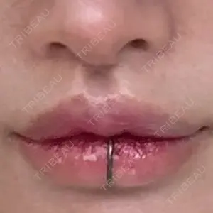 R Beauty CLINIC 銀座院の