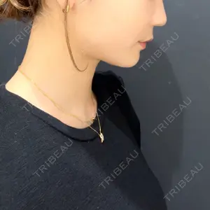 口コミ