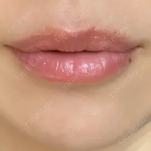 ルラ美容クリニック ルラ美容クリニック 名古屋本院口コミ